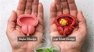 صحة البروستاتا