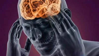 علامات ارتفاع ضغط المخ