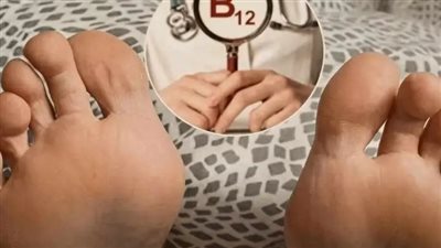 علامات تدل علي نقص قيتامين ب12
