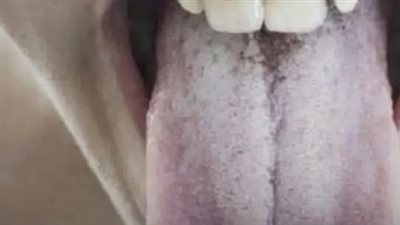 اخرج لسانك الان