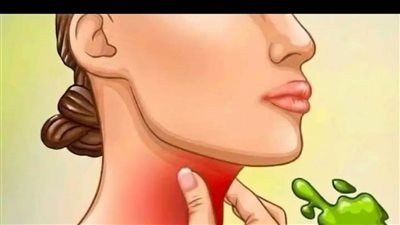 الأسباب الحقيقية لتراكم المخاط في الحلق وهكذا تتخلص من تراكمه في ٣ دقـائق 