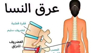 وصفة “منزلية” معجزة للتخلص من آلام المفاصل والساقين والعمود الفقري و إلتهاباتهم بشكل نهائي