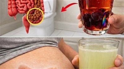 وداعاً للإمساك المـزعج